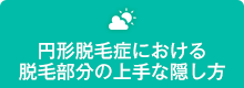 円形脱毛症における脱毛部分の上手な隠し方