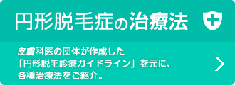 円形脱毛症の治療法