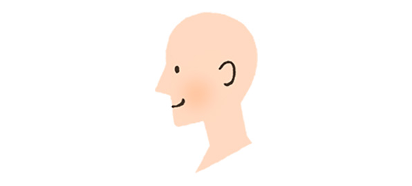 汎発（ばんぱつ）型