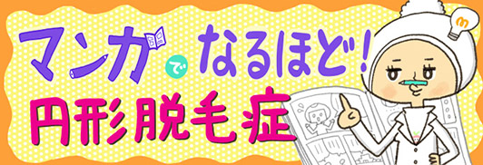 マンガでなるほど！円形脱毛症