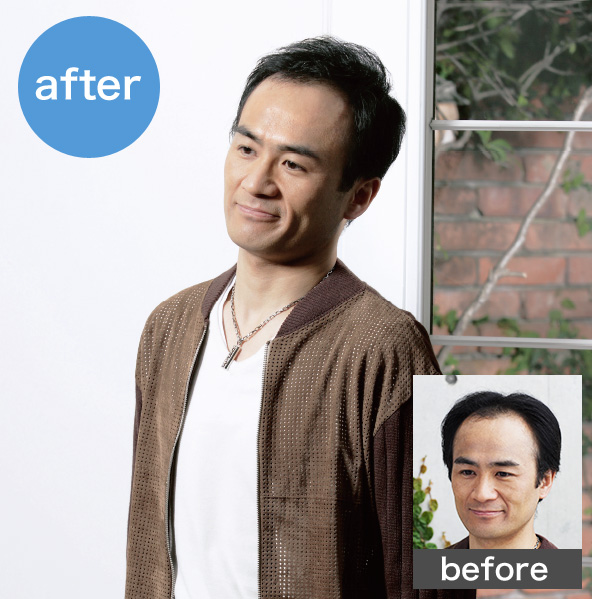 after before