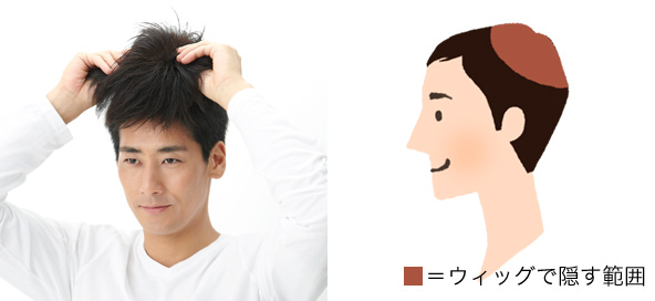 部分ウィッグ(かつら)